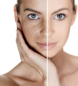 Skin Issues That Laser Skin Resurfacing Can Help